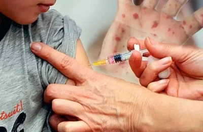 Bangladeş’te kızamık şüphesi: 113 çocuk öldü